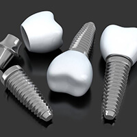 three dental implants, abutments, and crowns lying on a table