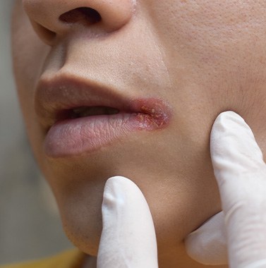 Dentist looking at oral abnormality on patient's lips