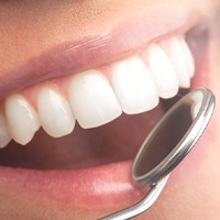 Close-up photo of a beautiful smile after cosmetic bonding in Bellingham