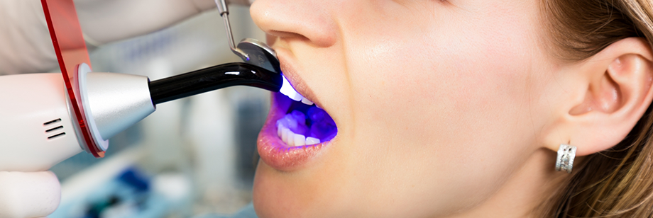 Woman getting cosmetic dental bonding on her front tooth