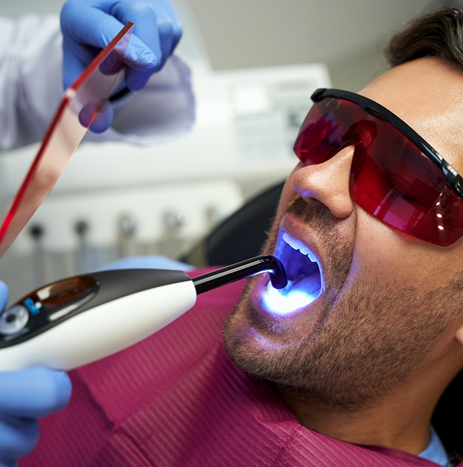 Man getting cosmetic dental bonding on a lower front tooth