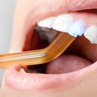 Cosmetic bonding procedure being done at the dentist