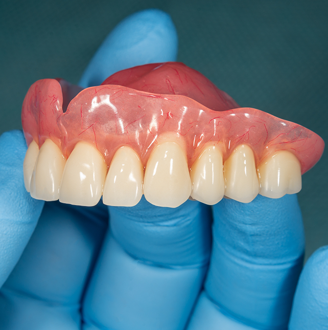 Gloved hand holding a full denture