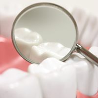 Closeup of teeth with dental sealants