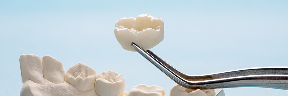 Tweezers placing a dental crown over a model of a tooth
