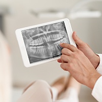 Panoramic digital dental x-ray