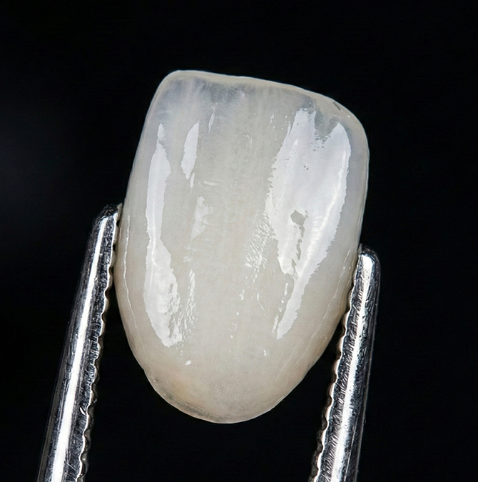 Close up of a tweezer holding a dental veneer