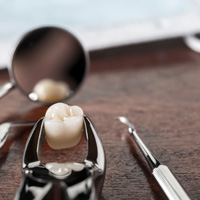 dental forceps holding a wisdom tooth