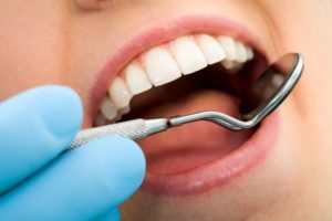 woman with mouth open dental exam