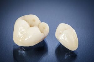 tooth colored porcelain dental crown